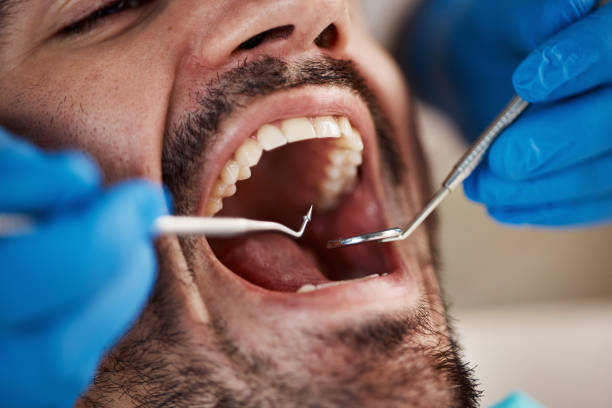 Best Tooth Pain Emergency Relief  in Granite, OK