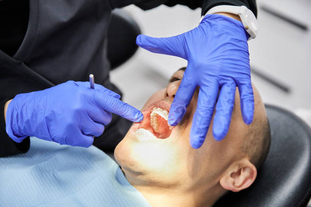Best Dentist for Dental Trauma  in Granite, OK