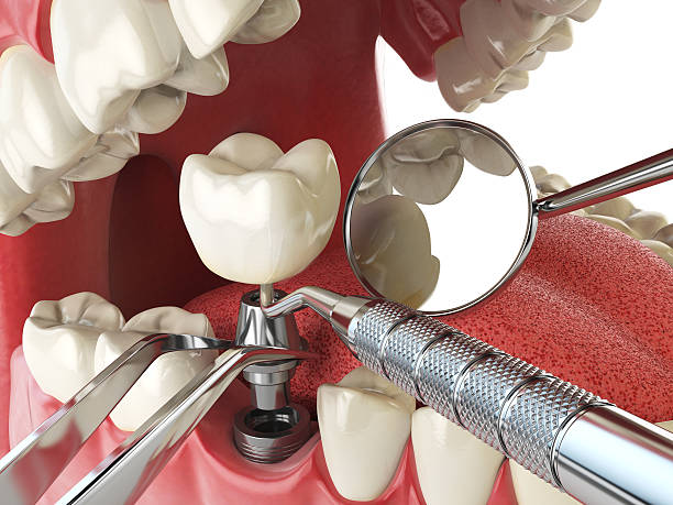 Best Root Canal Emergency Dentist  in Granite, OK